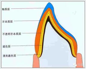 牙体预备的基础知识